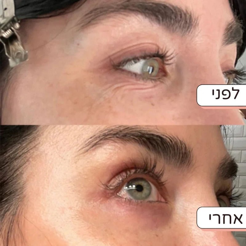 מארז חידוש הפנים של דיילי - להפחתת מראה קמטים וצלקות - Dayli